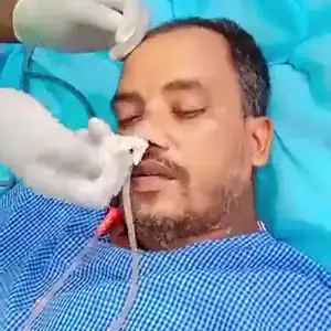 Nasogastric tube (Ryle's tube) care at home